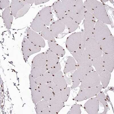 Immunohistochemistry-Paraffin: PSPC1 Antibody [NBP1-83801]