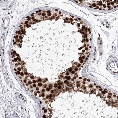 Immunohistochemistry-Paraffin: PSPC1 Antibody [NBP1-83801]