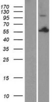 Western Blot: PSPC1 Overexpression Lysate [NBP2-08362]