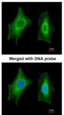 Immunocytochemistry/ Immunofluorescence: PSPHL Antibody [NBP1-32723]