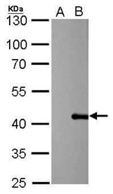 Western Blot: PSRC1 Antibody (615) [NBP2-43790]