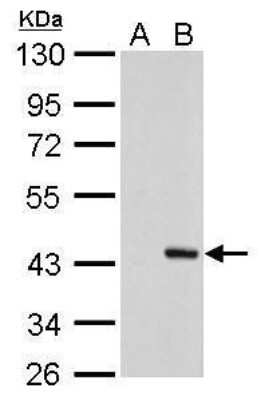 Western Blot: PSRC1 Antibody (982) [NBP2-43791]