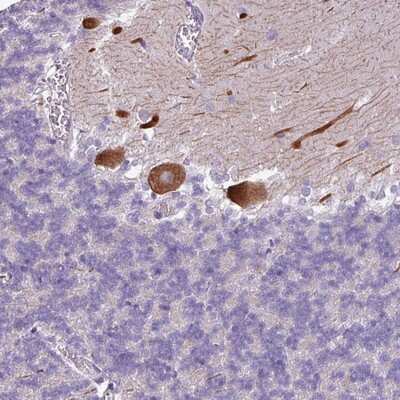 Immunohistochemistry-Paraffin: PSRC1 Antibody [NBP2-13823]