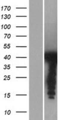 Western Blot: PSRC1 Overexpression Lysate [NBP2-05984]