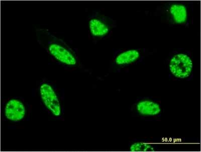 Immunocytochemistry/ Immunofluorescence: PSRC2 Antibody (3A3) [H00196441-M07]