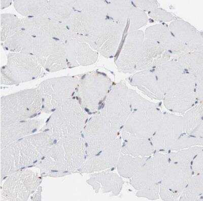 Immunohistochemistry-Paraffin: PSRC2 Antibody [NBP1-88166]