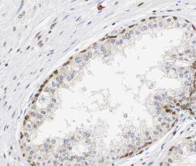 Immunohistochemistry-Paraffin: PSRC2 Antibody [NBP1-88166]