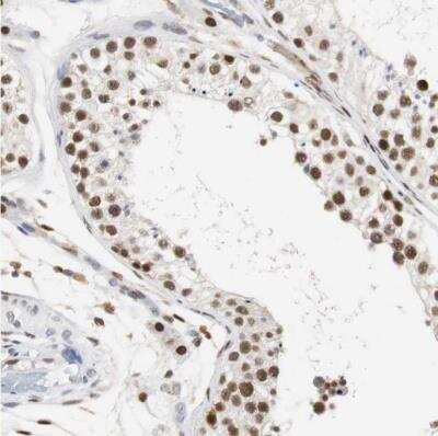 Immunohistochemistry-Paraffin: PSRC2 Antibody [NBP1-88166]