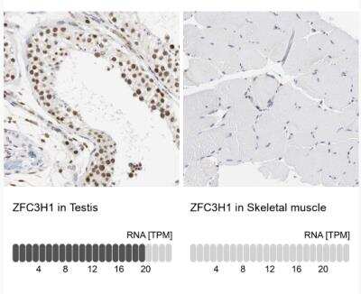 Immunohistochemistry-Paraffin: PSRC2 Antibody [NBP1-88166]