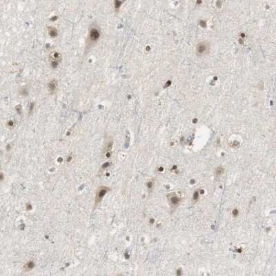 Immunohistochemistry-Paraffin: PSRC2 Antibody [NBP1-88166]