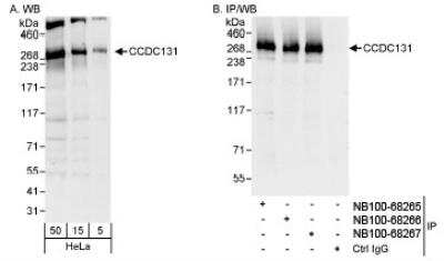 Western Blot: PSRC2 Antibody [NB100-68265]