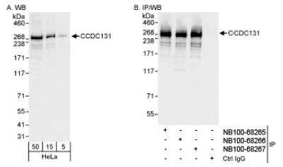 Western Blot: PSRC2 Antibody [NB100-68266]