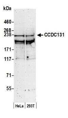 Western Blot: PSRC2 Antibody [NB100-68267]