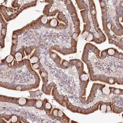 Immunohistochemistry-Paraffin: PSTK Antibody [NBP2-48678]