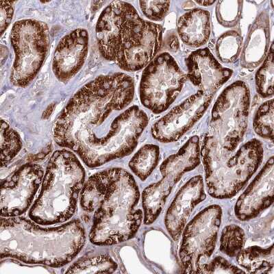 Immunohistochemistry-Paraffin: PSTK Antibody [NBP2-48678]