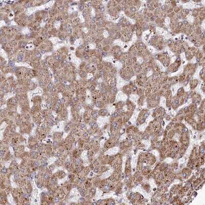 Immunohistochemistry-Paraffin: PSTK Antibody [NBP2-48678]