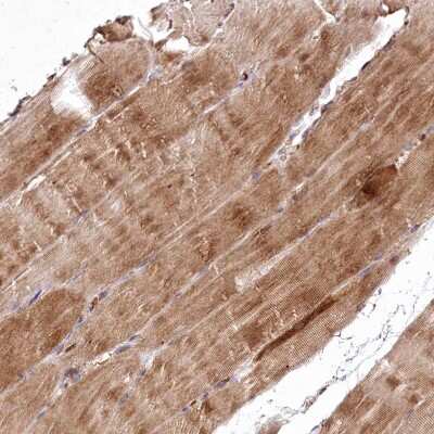 Immunohistochemistry-Paraffin: PSTK Antibody [NBP2-48678]