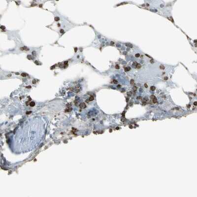 Immunohistochemistry-Paraffin: PSTPIP1 Antibody [NBP1-85764]