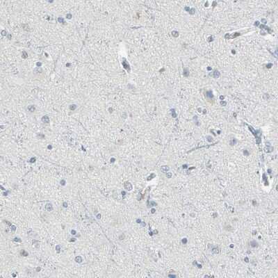 Immunohistochemistry-Paraffin: PSTPIP1 Antibody [NBP1-85764]