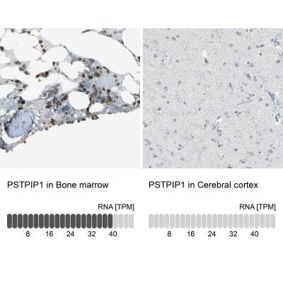 Immunohistochemistry-Paraffin: PSTPIP1 Antibody [NBP1-85764]