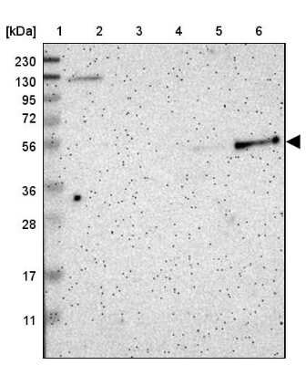 Western Blot: PSTPIP1 Antibody [NBP1-85764]