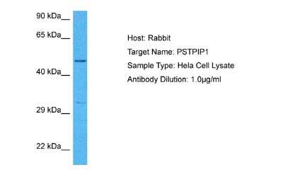 Western Blot: PSTPIP1 Antibody [NBP2-85555]