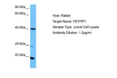 Western Blot: PSTPIP1 Antibody [NBP2-85556]