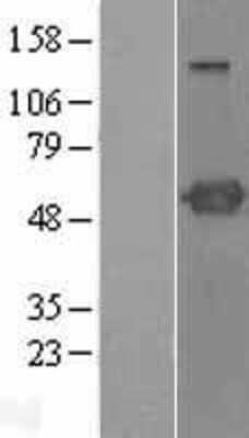 Western Blot: PSTPIP1 Overexpression Lysate [NBL1-14915]