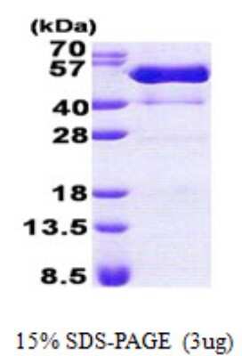 SDS-PAGE: Recombinant Human PSTPIP1 His Protein [NBP2-23369]