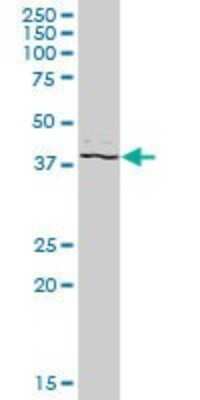 Western Blot: PSTPIP2 Antibody [H00009050-B01P]