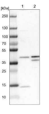 Western Blot: PSTPIP2 Antibody [NBP1-85846]