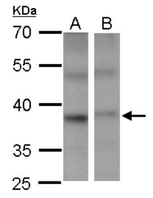 Western Blot: PSTPIP2 Antibody [NBP2-19995]