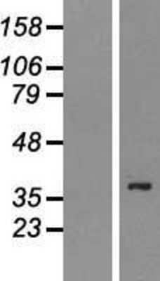 Western Blot: PSTPIP2 Overexpression Lysate [NBP2-06333]