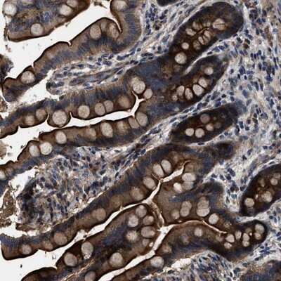 Immunohistochemistry-Paraffin: PTAR1 Antibody [NBP1-91075]