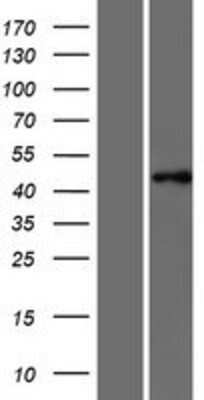 Western Blot: PTAR1 Overexpression Lysate [NBP2-08289]