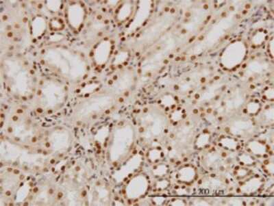 Immunohistochemistry-Paraffin: PTBP1 Antibody (3H8) [H00005725-M01]