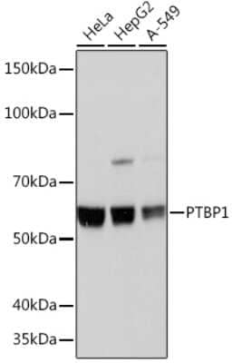 Western Blot: PTBP1 Antibody (9M6A8) [NBP3-16197]