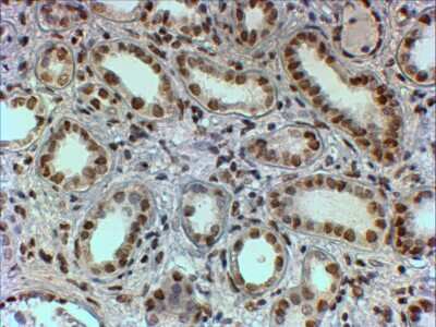 Immunohistochemistry-Paraffin: PTBP1 Antibody [NB100-1310]