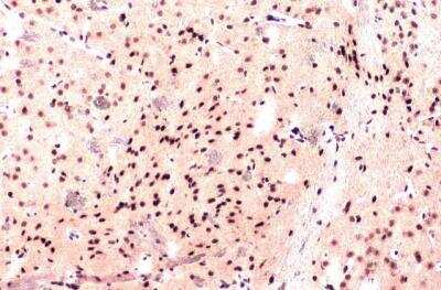 Immunohistochemistry-Paraffin: PTBP1 Antibody [NBP2-19996]
