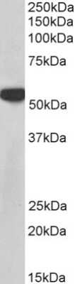 Western Blot: PTBP1 Antibody [NB100-1310]