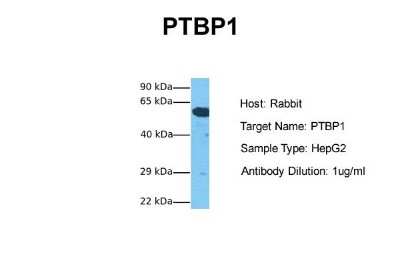 Western Blot: PTBP1 Antibody [NBP1-57123]