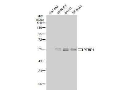 Western Blot: PTBP1 Antibody [NBP2-19996]