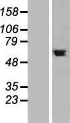 Western Blot: PTBP1 Overexpression Lysate [NBL1-14918]