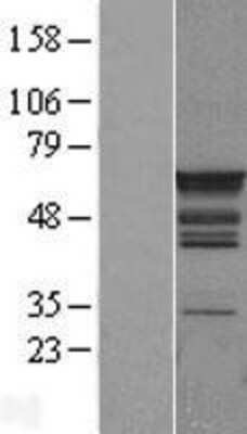 Western Blot: PTBP1 Overexpression Lysate [NBL1-14919]