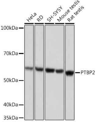 Western Blot: PTBP2 Antibody (10S9P6) [NBP3-16756]