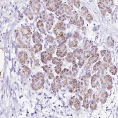 Immunohistochemistry-Paraffin: PTBP2 Antibody [NBP1-92302]