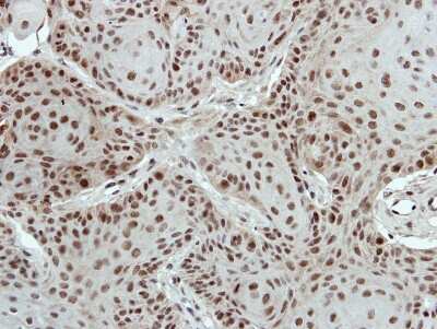 Immunohistochemistry-Paraffin: PTBP2 Antibody [NBP2-19997]