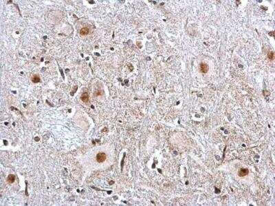 Immunohistochemistry-Paraffin: PTBP2 Antibody [NBP2-19997]