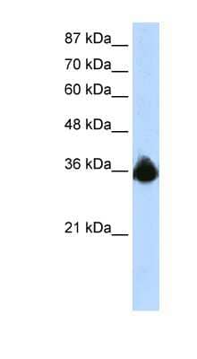 Western Blot: PTBP2 Antibody [NBP1-57401]