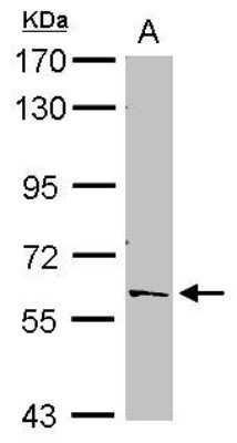 Western Blot: PTBP2 Antibody [NBP2-19997]
